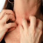 mujer con reacción alérgica a un collar de bisutería