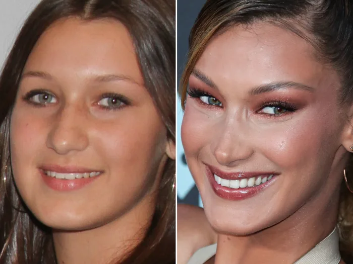 bella hadid evolucion cara