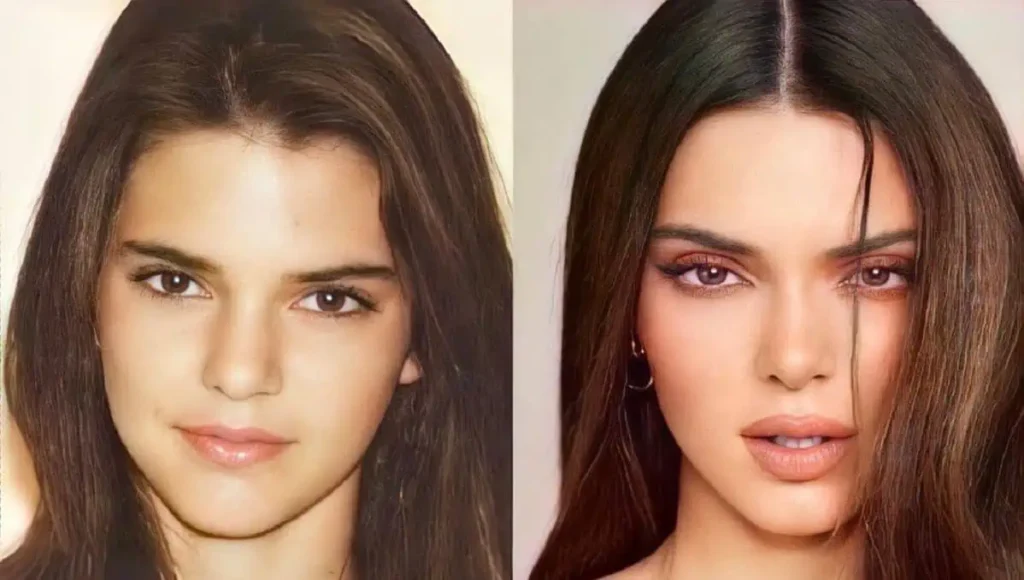 kendall jenner antes despues